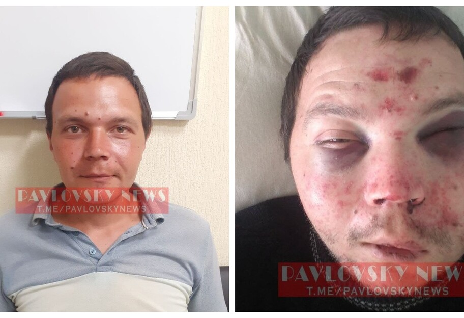 В Киеве избили таксиста Uber - фото, видео  - фото 1
