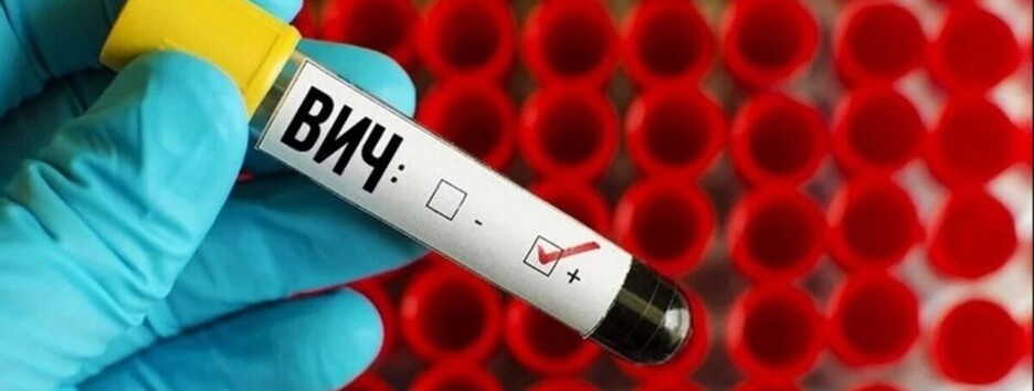 Профилактика ВИЧ-инфекции во время войны: в МОЗ дали несколько советов 