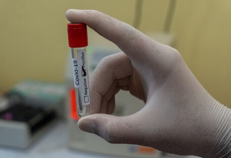 Перемогти коронавірус в 2021 році не вдасться: що ж чекає Україну в пандемії