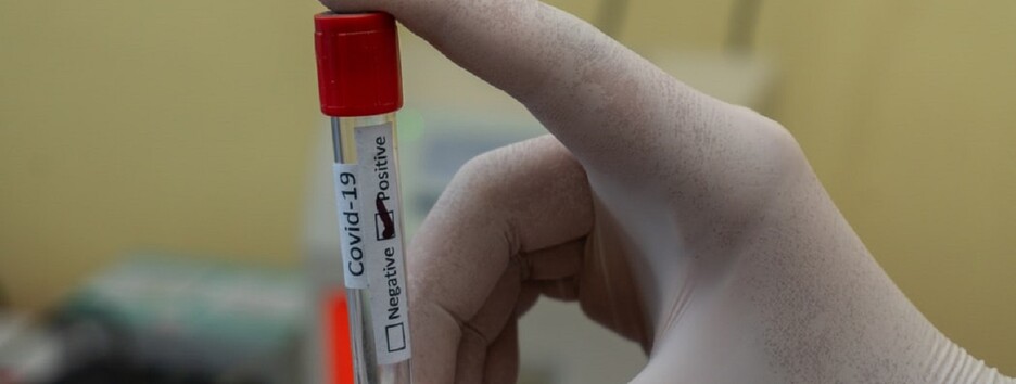 Перемогти коронавірус в 2021 році не вдасться: що ж чекає Україну в пандемії