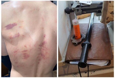 Пытки в отделении полиции: еще трем копам объявили подозрение