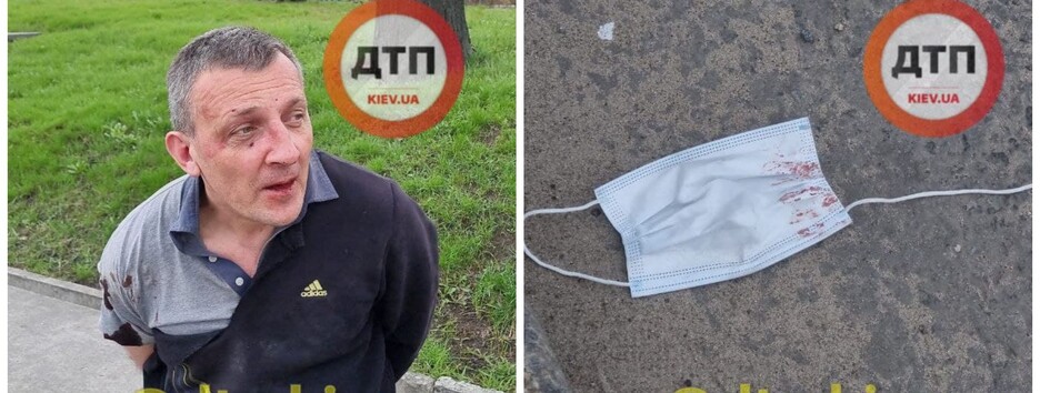 У Києві маршрутник, який порушив карантин, побився з поліцейськими (фото)