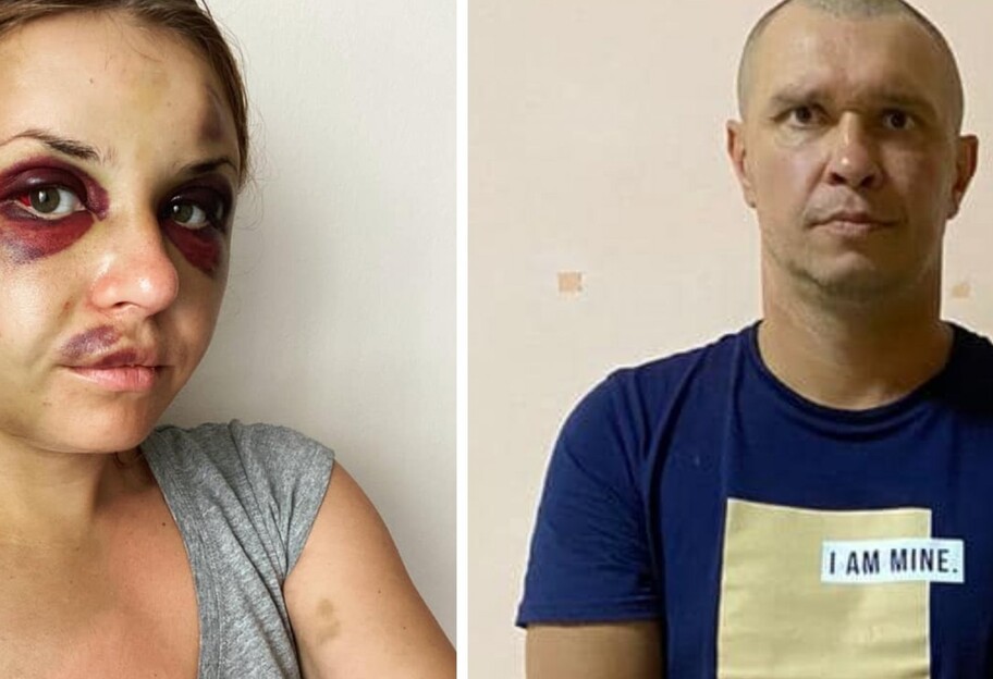 Анастасия Луговая заявила, что напавший на нее мужчина умер в СИЗО - подробности - фото 1