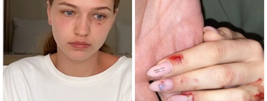 Украинку избили в самолете: пострадавшая рассказала, как это произошло (видео)