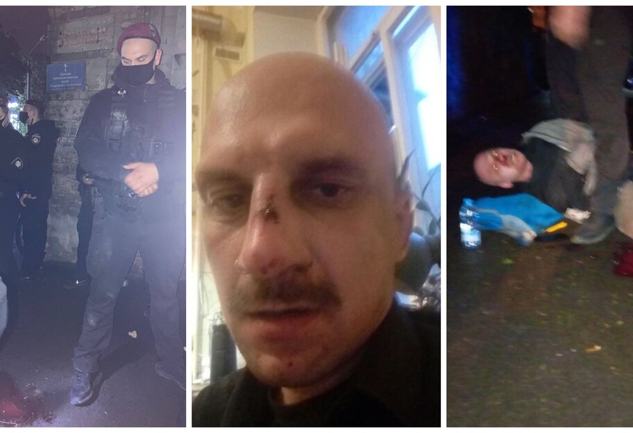 Полицейские избили художника в Киеве - Митя Бугайчук показал фото - фото 1