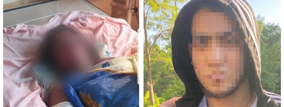 В Кривом Роге умерла беременная, которую поджег ее 17-летний сожитель