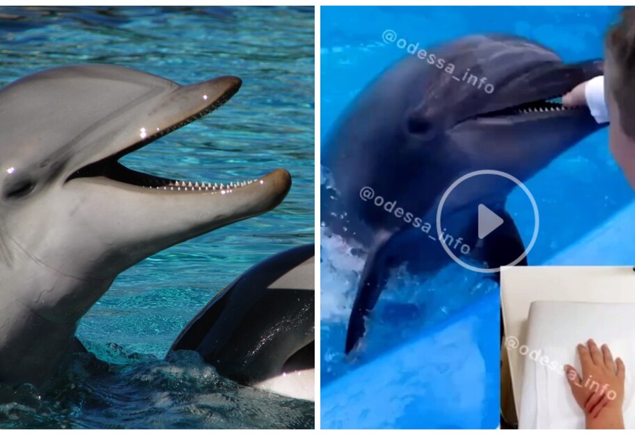 Вкусив дельфін в Одесі - хлопчикові наклали на руку шви - відео - фото 1