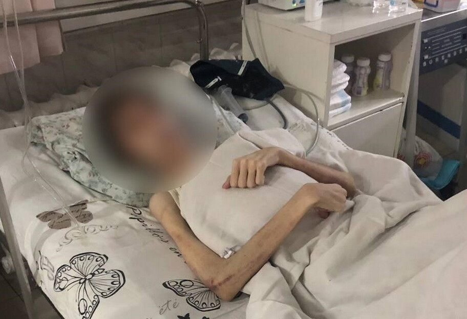 Одессит заморил голодом сына в Одессе - мальчика госпитализировали  - фото 1