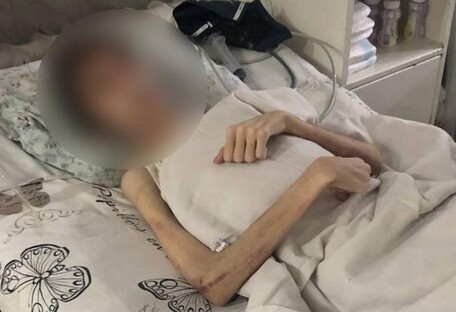 В Одессе мужчина голодом изгонял из 16-летнего сына 