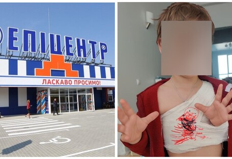 В киевском гипермаркете на ребенка упал стеллаж, он в больнице (фото)