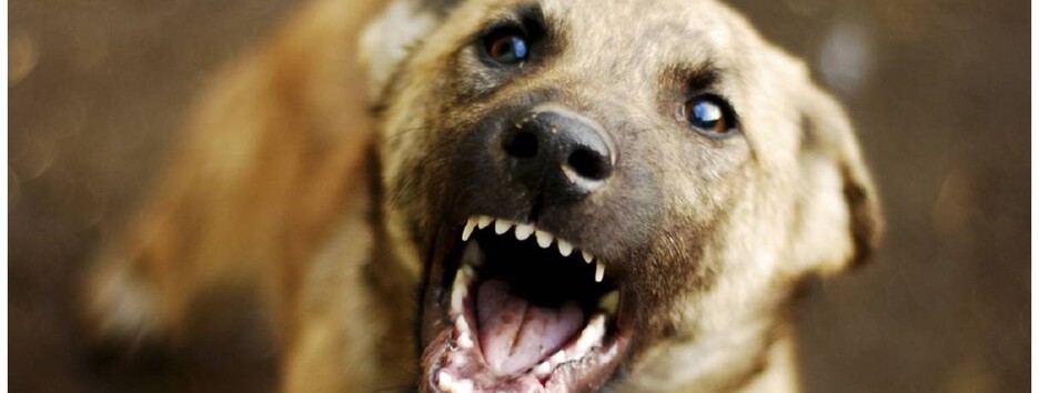 В Одессе ребенок попал в больницу после нападения стаи собак (видео)