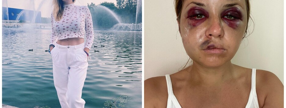 Избиение телеведущей в поезде на Киев: суд вынес первое решение