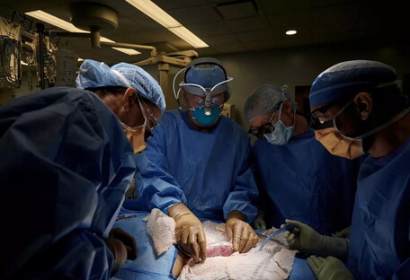 Людині вперше в історії пересадили нирку від генно-модифікованої свині