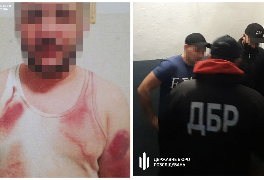 Поліцейські побили чоловіка в Києві, фото, відео - фото 1