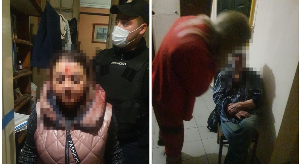 Вдарили по голові та залили газом: у Києві "соцпрацівниці" напали на пенсіонера (фото) фото