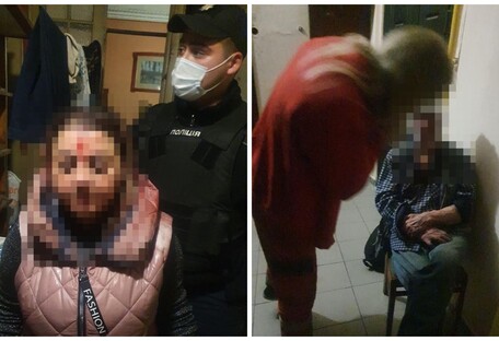 Ударили по голове и залили газом: в Киеве 