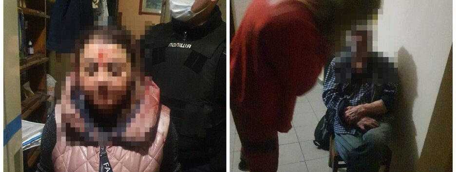 Вдарили по голові та залили газом: у Києві 