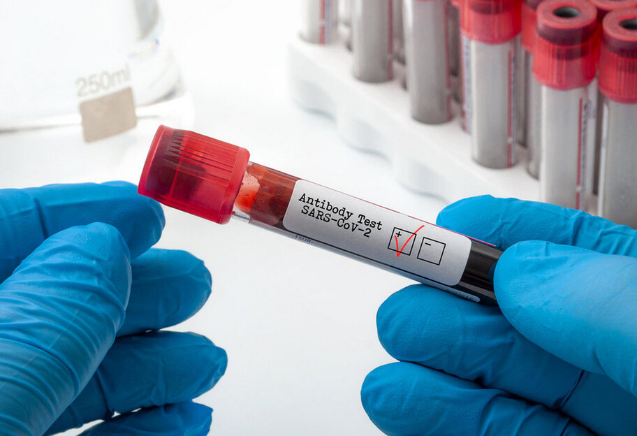 Вакцинація від коронавірусу – який аналіз здати, щоб перевірити наявність антитіл - фото 1