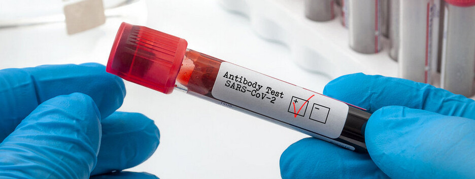 Назван анализ, который стоит сдать после вакцинации или COVID