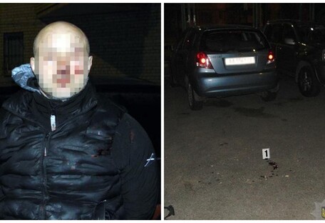 Полицейского прооперировали: в Киеве нарушитель ПДД напал на копа (фото)