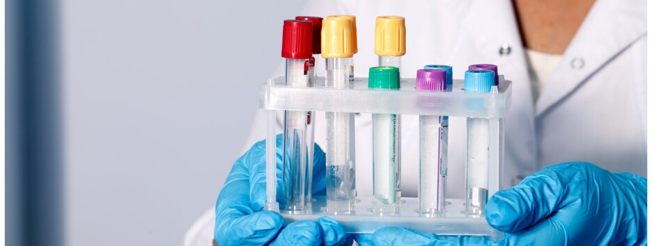 Лікар назвав чотири аналізи, які потрібно здати всім хворим COVID