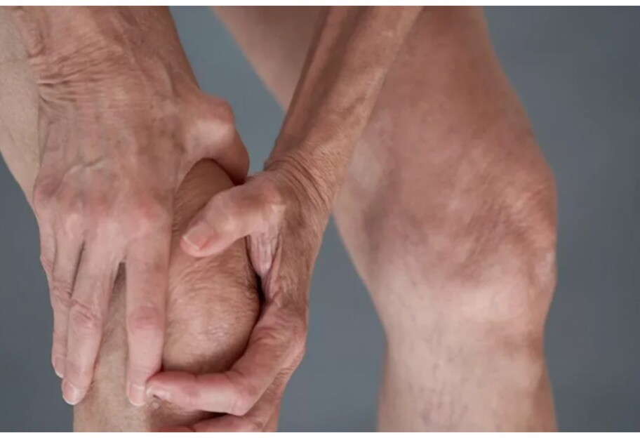 Профілактика артриту – названий корисний продукт для зменшення симптомів - фото 1