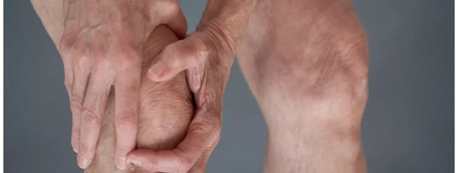 Названий найкращий продукт для профілактики артриту – достатньо їсти двічі на тиждень