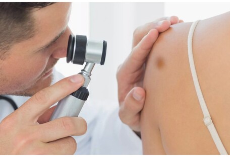 Медики назвали опасные симптомы рака кожи, проявляющиеся на лице