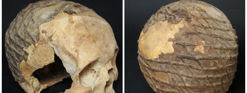 Відкрито секрет 9000-річного черепа, покритого асфальтом (фото) 