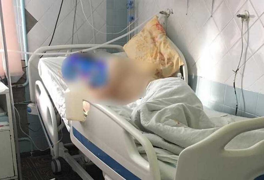 В Одесской области 16-летнему парню ампутировали ноги - он их отморозил - фото 1