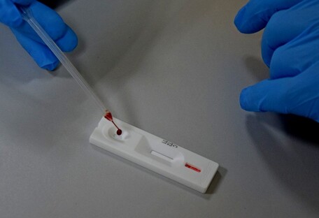 Украинские ученые создали новые ПЦР-тесты: они могут обнаружить коронавирус и грипп