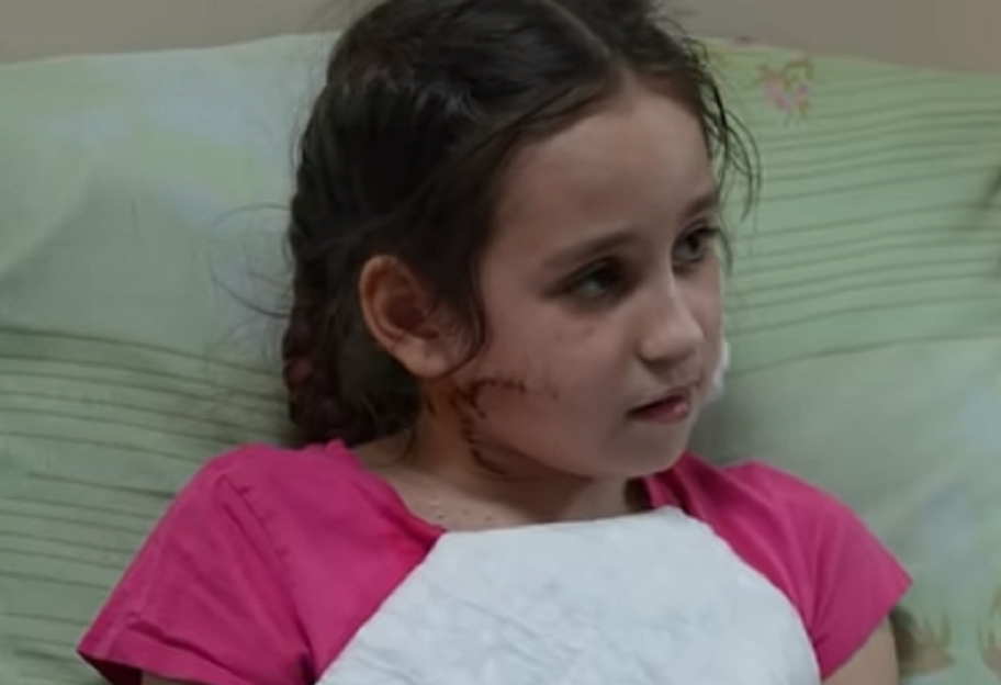 В Мариуполе оккупант выстрелил в лицо девочке - ее удалось спасти - видео  - фото 1