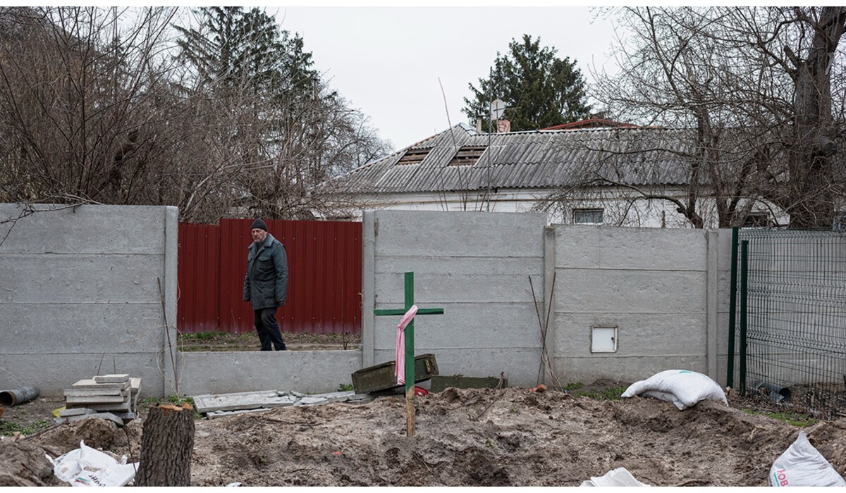 Фото пулевых ранений человека