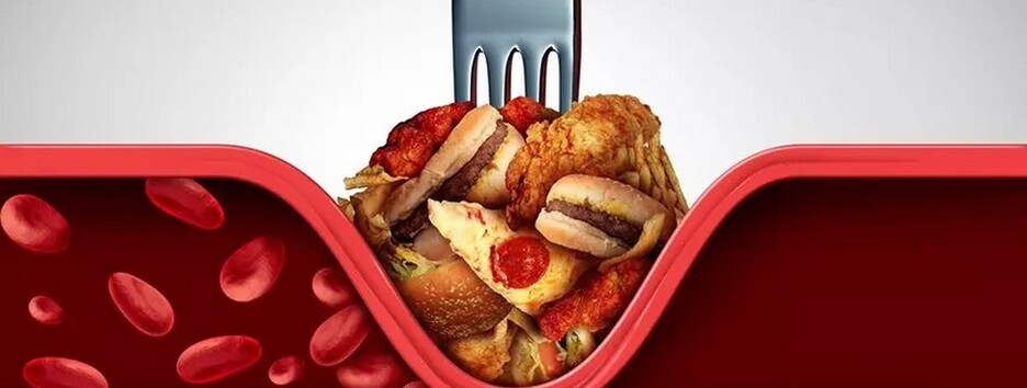 Холестерин не завжди погано: дієтолог розповіла навіщо організму цей компонент