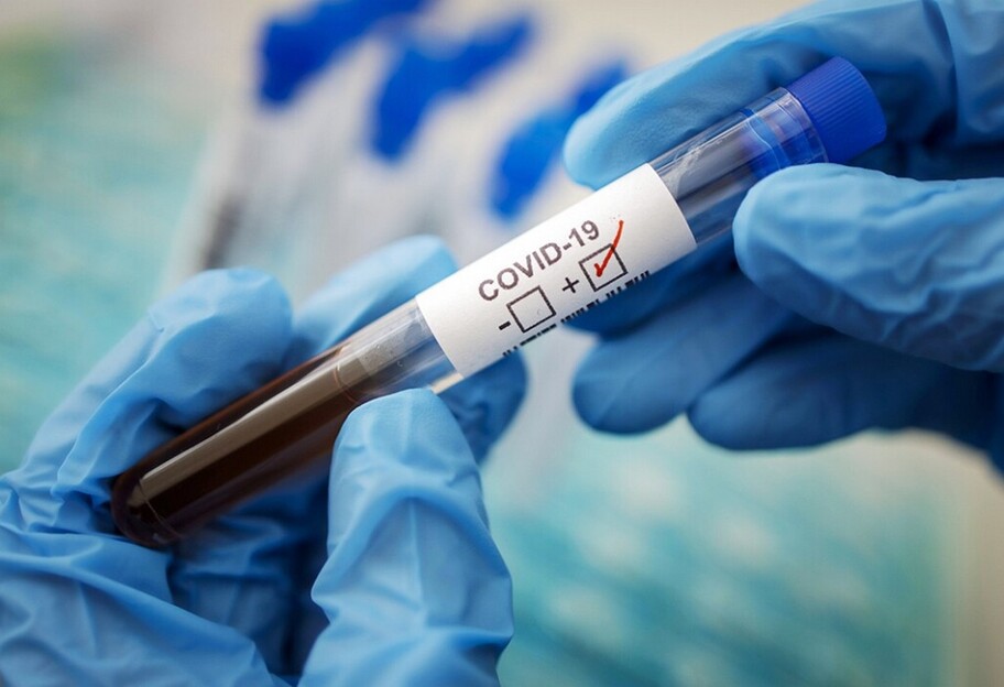 Новая вспышка коронавируса в Украине - когда заболевание может достигнуть пика - фото 1