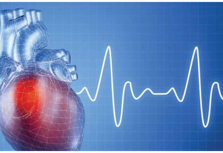 Как распознать и предупредить инфаркт: советы врачей