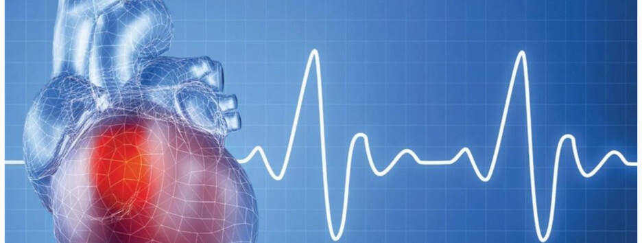 Як розпізнати та попередити інфаркт: поради лікарів 