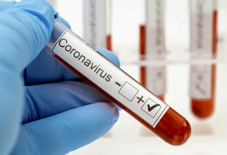 Майже 640 млн людей захворіли COVID-19: статистика по країнах