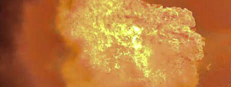 Из-за обстрелов рф в Херсонской области погиб человек, еще семь ранены — ОГА