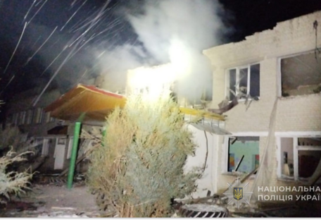 За сутки из-за обстрелов Сумщины ранения получили семь человек, среди них двое детей (фото)