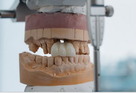 Правительство расширило программу бесплатного стоматологического протезирования: кто может получить помощь