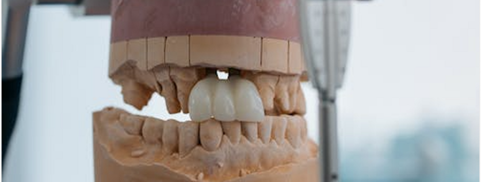 Правительство расширило программу бесплатного стоматологического протезирования: кто может получить помощь
