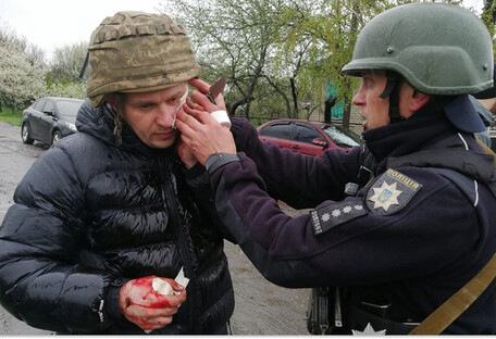 На Днепропетровщине мужчина бросил гранату в полицейских: пятеро раненых