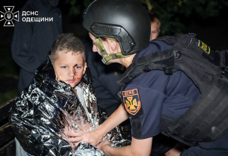 В Одессе в результате обстрела пострадали 17 человек, среди которых трое — дети