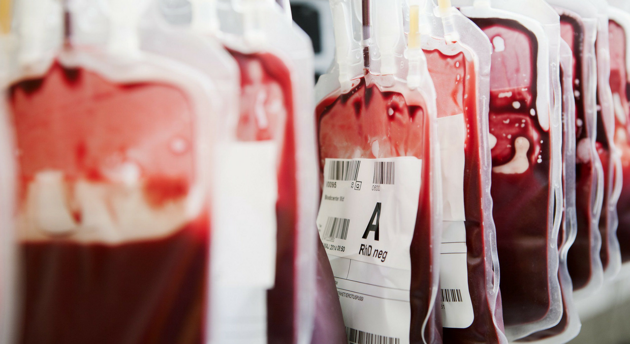 Может ли кровь молодых доноров вылечить пожилых людей с деменцией