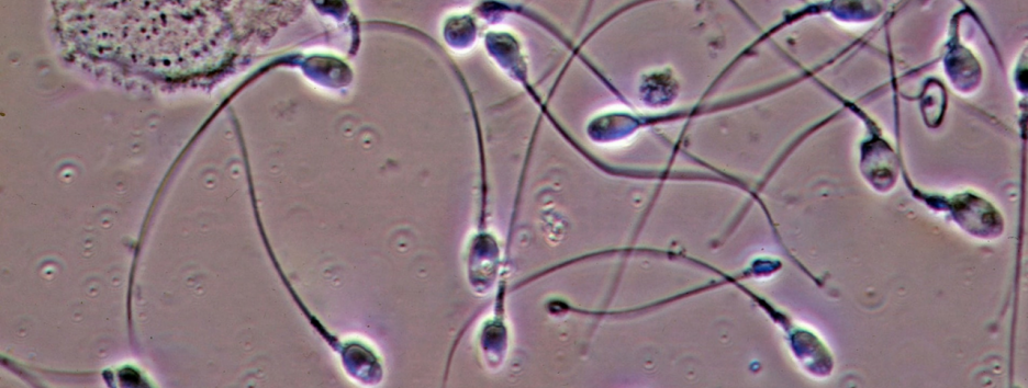 Грязный воздух может стать причиной мужского бесплодия