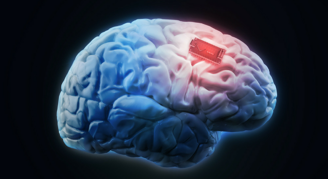В США испытывают мозговые импланты, улучшающие настроение - как это работает