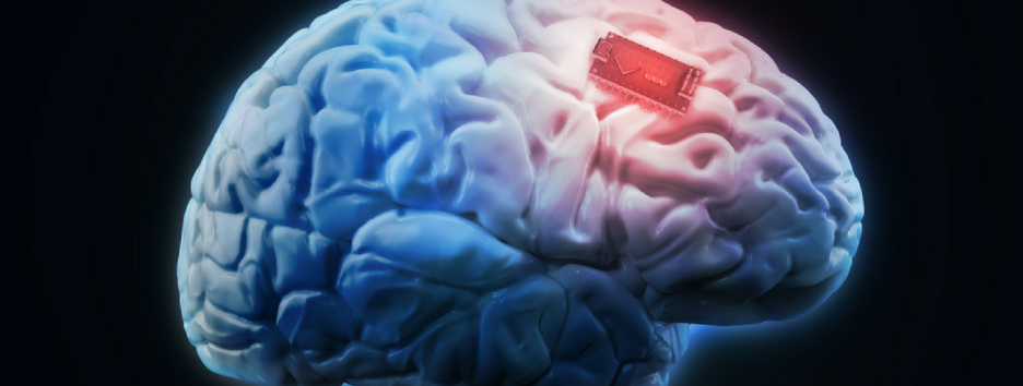 В США испытывают мозговые импланты, улучшающие настроение - как это работает