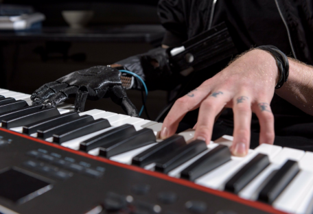 Потерявший руку музыкант смог играть на фортепиано благодаря уникальному протезу