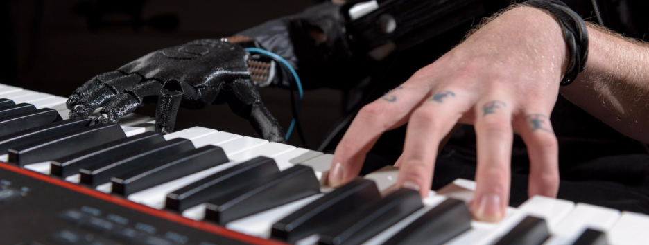 Потерявший руку музыкант смог играть на фортепиано благодаря уникальному протезу